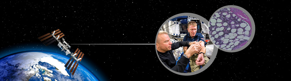 MARROW banner